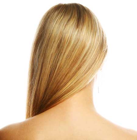 รังแคเป็นแผ่น รังแคเป็นแผ่น