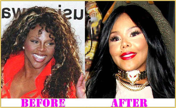 ดาราฮอลลีวูดศัลยกรรม ดาราฮอลลีวูดศัลยกรรม