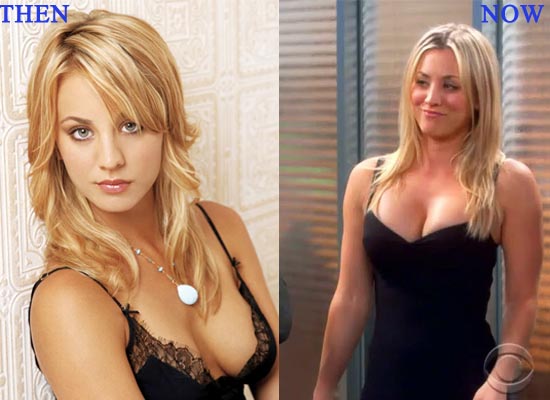 ศัลยกรรมหน้าอก ศัลยกรรมหน้าอก