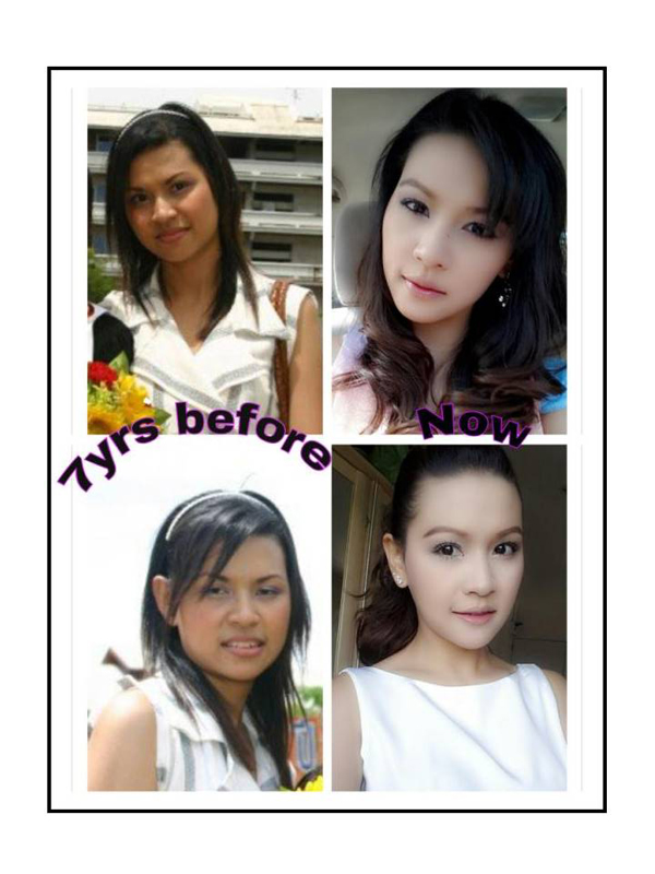 ศัลยกรรม ศัลยกรรม