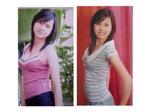 ศัลยกรรม ศัลยกรรม