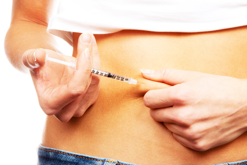 ฉีดไขมัน