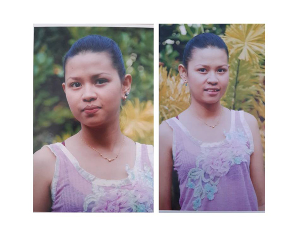 ศัลยกรรม ศัลยกรรม