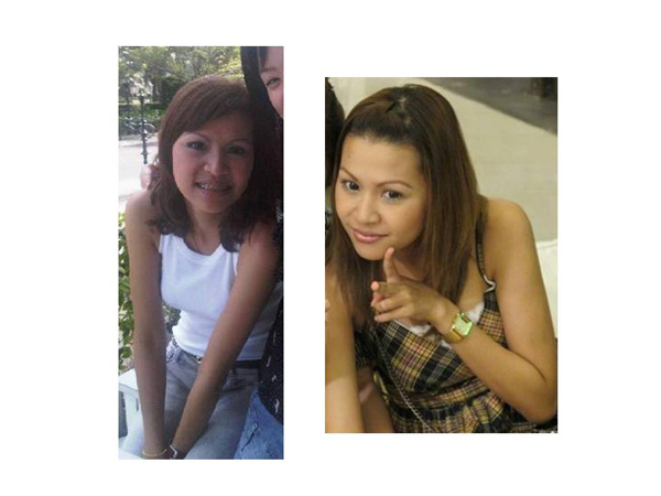 ศัลยกรรม ศัลยกรรม