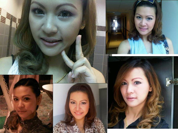 ศัลยกรรม ศัลยกรรม