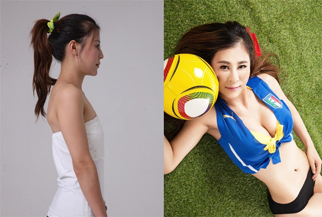 ศัลยกรรม ศัลยกรรม