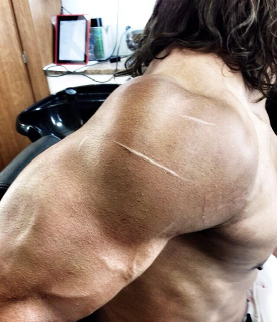 Hercules Hercules