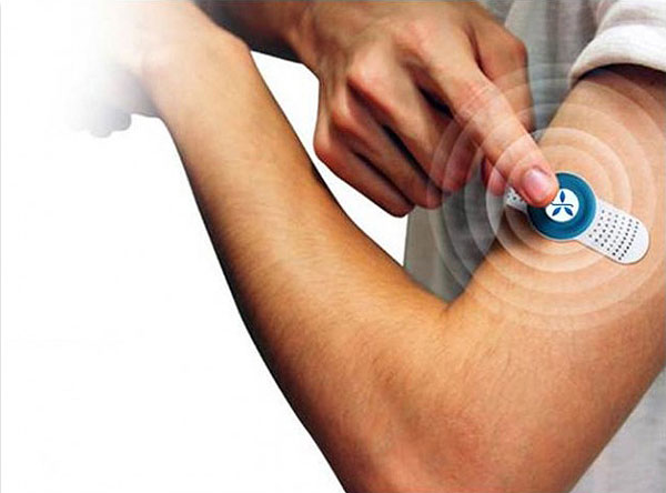 Transcutaneous Electrical Nerve Stimulation Transcutaneous Electrical Nerve Stimulation