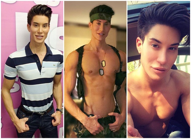 ศัลยกรรมแปลงโฉมเป็นหนุ่มบาร์บี้ ศัลยกรรมแปลงโฉมเป็นหนุ่มบาร์บี้