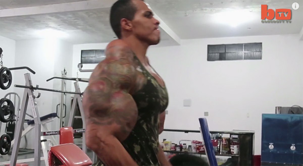 อยากกล้ามโตเหมือนฮัลค์จนเกือบโดนตัดแขนทิ้ง อยากกล้ามโตเหมือนฮัลค์จนเกือบโดนตัดแขนทิ้ง