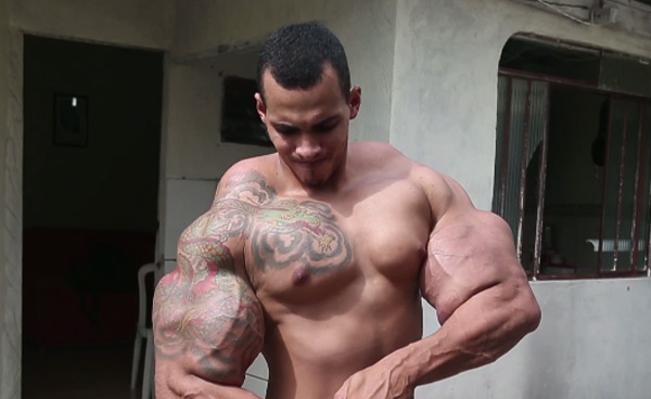 อยากกล้ามโตเหมือนฮัลค์จนเกือบโดนตัดแขนทิ้ง อยากกล้ามโตเหมือนฮัลค์จนเกือบโดนตัดแขนทิ้ง