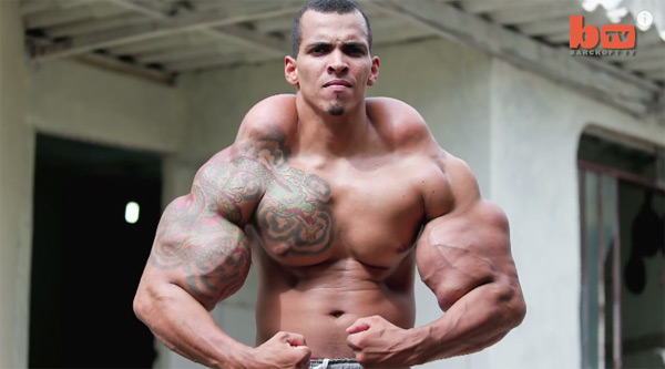 อยากกล้ามโตเหมือนฮัลค์จนเกือบโดนตัดแขนทิ้ง อยากกล้ามโตเหมือนฮัลค์จนเกือบโดนตัดแขนทิ้ง