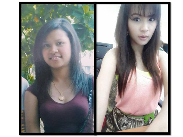 ศัลยกรรม