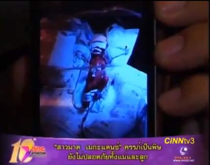 สาวมาด เมกะแด๊นซ์ อาการทรุดหนัก แฟนหนุ่มรอปาฏิหาริย์