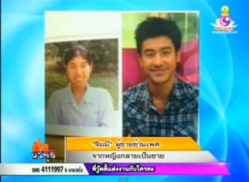 จิมมี่ ผู้ชายข้ามเพศ