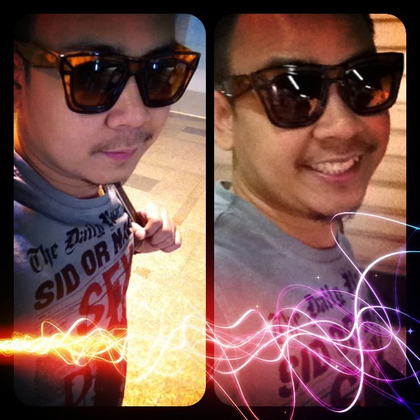 ท็อฟฟี่ ตลกหกฉาก เศร้า คุณแม่เสียชีวิตด้วยโรคมะเร็งวัย 62 ปี