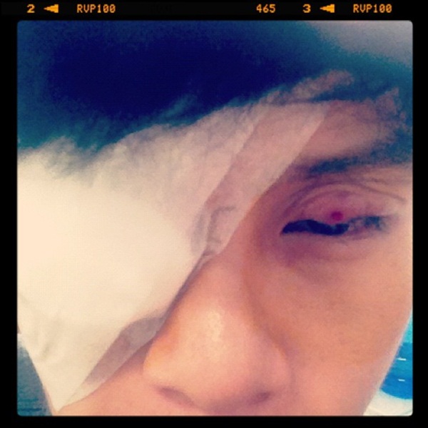 ดิว เดอะสตาร์ ผ่าตัดด่วน เหตุตาอักเสบรุนแรง หมอสั่งพักงาน