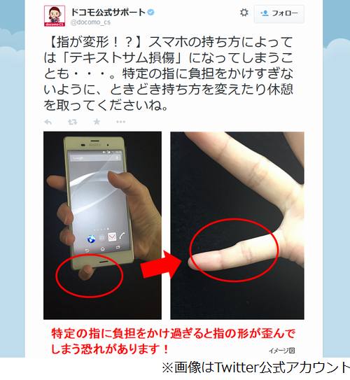 Smartphone Pinky ติดแชทมากไป ระวังนิ้วก้อยงอผิดรูปแบบนี้ Smartphone Pinky ติดแชทมากไป ระวังนิ้วก้อยงอผิดรูปแบบนี้