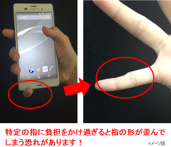 Smartphone Pinky ติดแชทมากไป ระวังนิ้วก้อยงอผิดรูปแบบนี้ Smartphone Pinky ติดแชทมากไป ระวังนิ้วก้อยงอผิดรูปแบบนี้