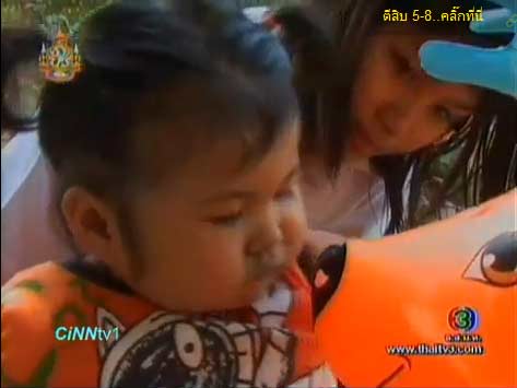 อัพเดทชีวิต น้องเนย ตีสิบ กับนิ้วมือใหม่ หลังผ่าตัด