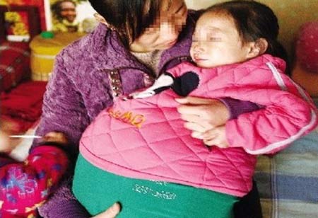 โรคประหลาด