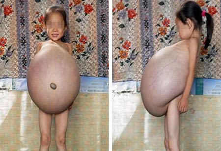 โรคประหลาด