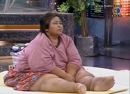 โรคบวมน้ำเหลือง