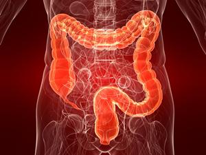 มะเร็งลำไส้ใหญ่