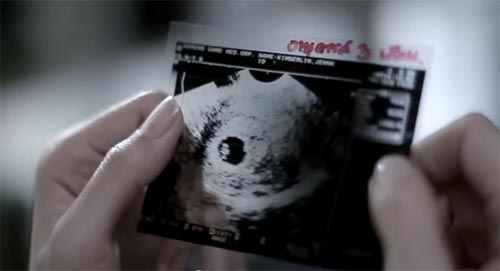 สุดเศร้า MV คนไม่น่าสงสาร จากเรื่องจริง Club Friday