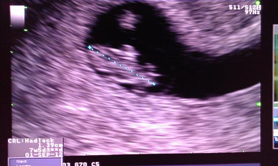 แบงค์ ทวีต นิหน่า ท้อง