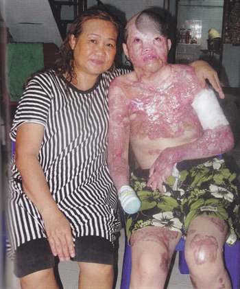 รัตนา แซ่ลิ้ม