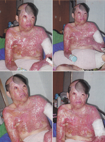 รัตนา แซ่ลิ้ม