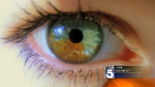 ศัลยกรรม เปลี่ยนสีตา