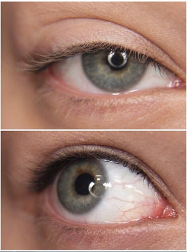 วิธีแก้หน้าโทรม