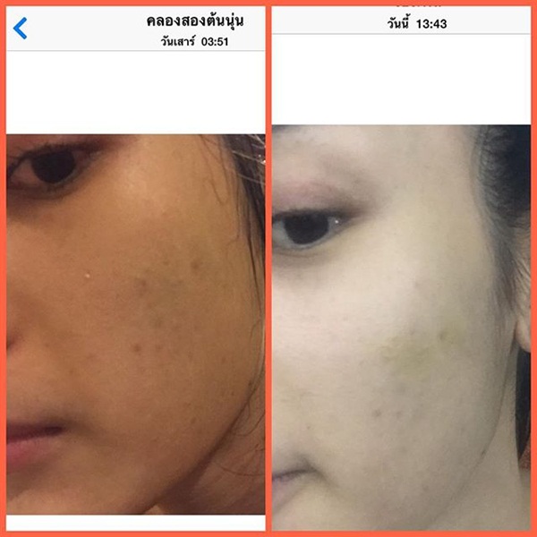 โบกัส ซุปตาร์ จัดหนัก น้ำเพชร