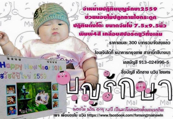 น้องไม้ วัย 1 ขวบ ต่อสู้กับมะเร็งสมอง