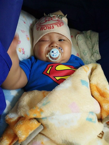 น้องไม้ วัย 1 ขวบ ต่อสู้กับมะเร็งสมอง