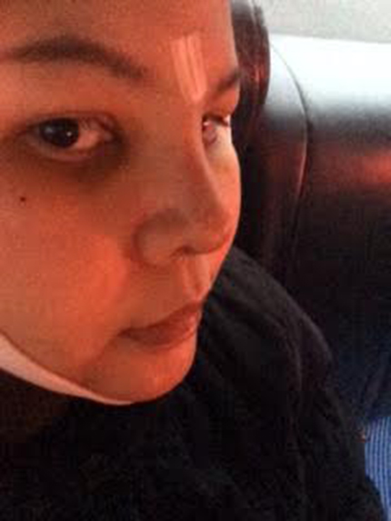 ศัลยกรรมเปลี่ยนชีวิต ศัลยกรรมเปลี่ยนชีวิต