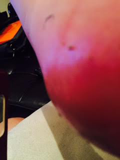 ศัลยกรรมเปลี่ยนชีวิต ศัลยกรรมเปลี่ยนชีวิต