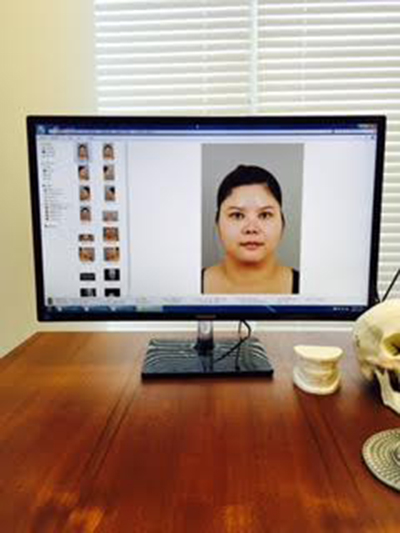 ศัลยกรรมเปลี่ยนชีวิต ศัลยกรรมเปลี่ยนชีวิต