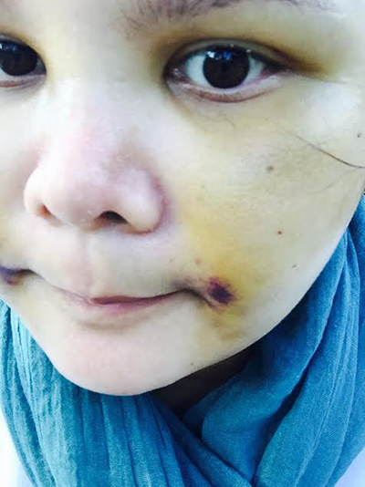 ศัลยกรรมเปลี่ยนชีวิต ศัลยกรรมเปลี่ยนชีวิต