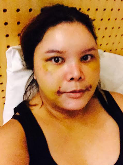 ศัลยกรรมเปลี่ยนชีวิต ศัลยกรรมเปลี่ยนชีวิต