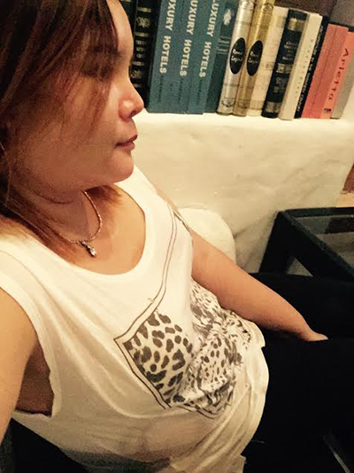 ศัลยกรรมเปลี่ยนชีวิต ศัลยกรรมเปลี่ยนชีวิต