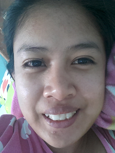 รีวิวจัดฟัน รีวิวจัดฟัน