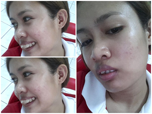 รีวิวจัดฟัน รีวิวจัดฟัน