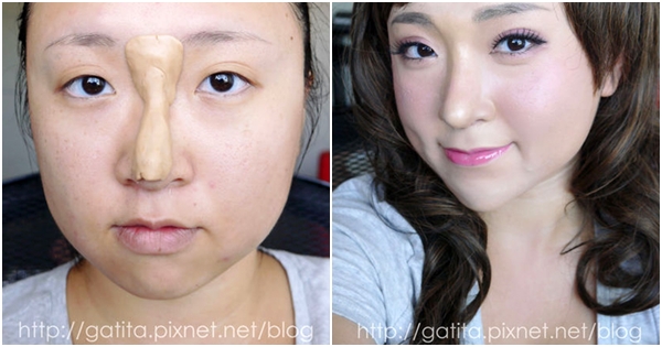 สาวจีนเสริมดั้งด้วยดิน