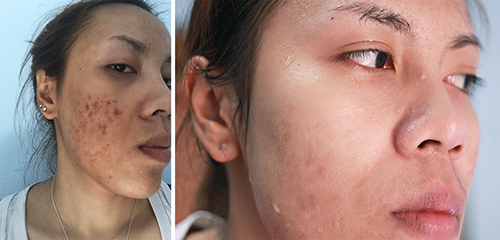 แชร์ประสบการณ์เปลี่ยนแปลงตัวเอง