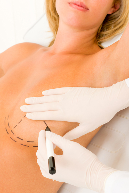 ศัลยกรรมหน้าอก