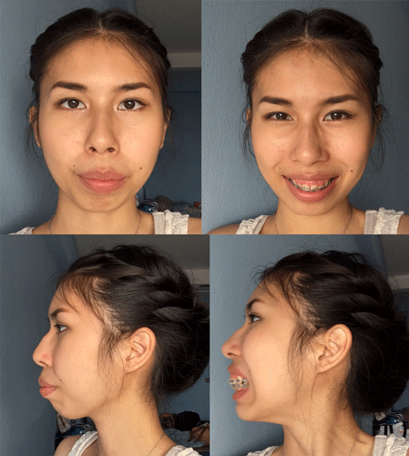 แชร์ประสบการณ์ศัลยกรรม