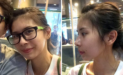 แชร์ประสบการณ์ศัลยกรรม